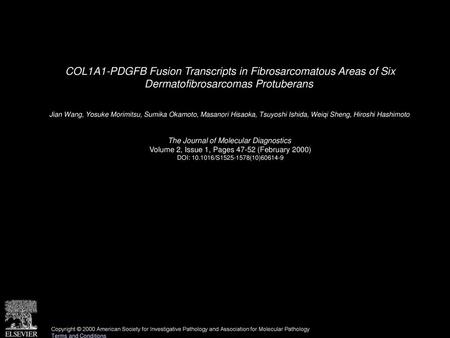 COL1A1-PDGFB Fusion Transcripts in Fibrosarcomatous Areas of Six Dermatofibrosarcomas Protuberans  Jian Wang, Yosuke Morimitsu, Sumika Okamoto, Masanori.