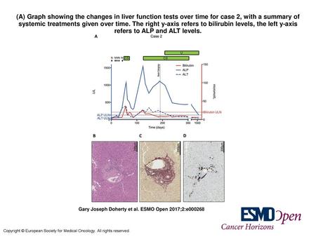 (A) Graph showing the changes in liver function tests over time for case 2, with a summary of systemic treatments given over time. The right y-axis refers.