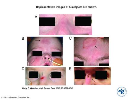 Representative images of 5 subjects are shown.