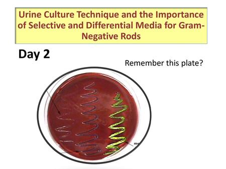 Urine Culture Technique and the Importance of Selective and Differential Media for Gram-Negative Rods Day 2 Remember this plate?