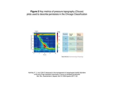 Figure 2 Key metrics of pressure topography (Clouse)