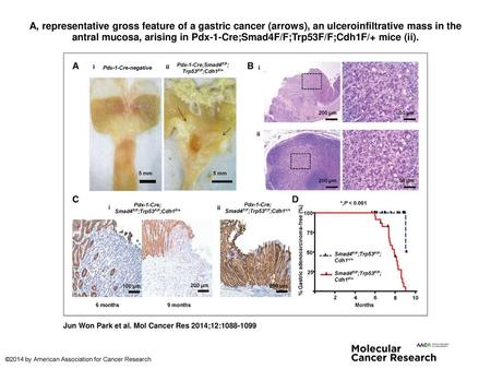 A, representative gross feature of a gastric cancer (arrows), an ulceroinfiltrative mass in the antral mucosa, arising in Pdx-1-Cre;Smad4F/F;Trp53F/F;Cdh1F/+