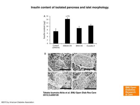 Insulin content of isolated pancreas and islet morphology.