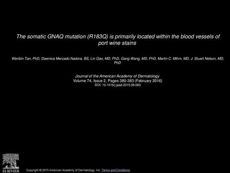 The somatic GNAQ mutation (R183Q) is primarily located within the blood vessels of port wine stains  Wenbin Tan, PhD, Dawnica Mercado Nadora, BS, Lin.