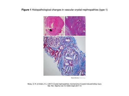 Nat. Rev. Nephrol. doi: /nrneph