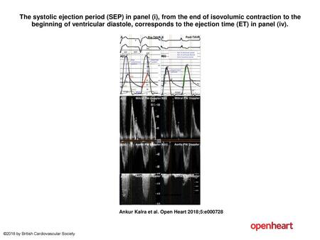 The systolic ejection period (SEP) in panel (i), from the end of isovolumic contraction to the beginning of ventricular diastole, corresponds to the ejection.