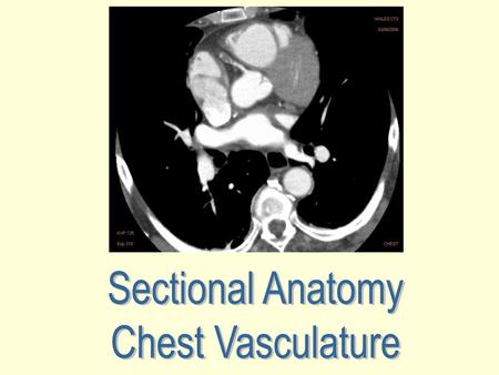 Sectional Anatomy Chest Vasculature.