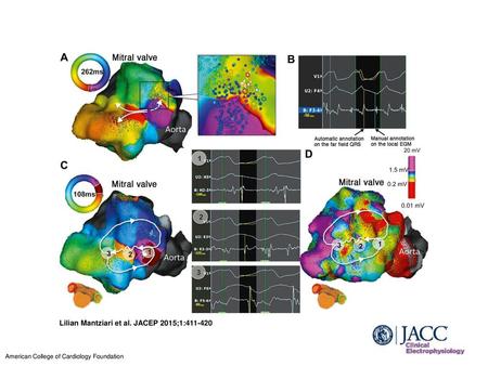 Lilian Mantziari et al. JACEP 2015;1: