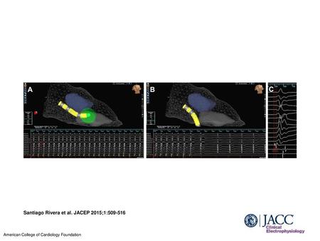 Santiago Rivera et al. JACEP 2015;1: