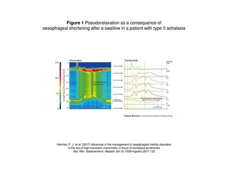 Figure 1 Pseudorelaxation as a consequence of