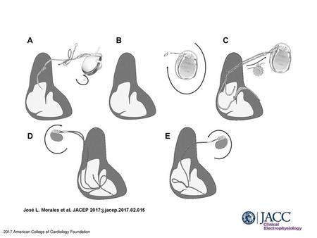 José L. Morales et al. JACEP 2017;j.jacep