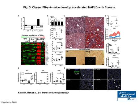 Fig. 3. Obese IFN-γ−/− mice develop accelerated NAFLD with fibrosis.