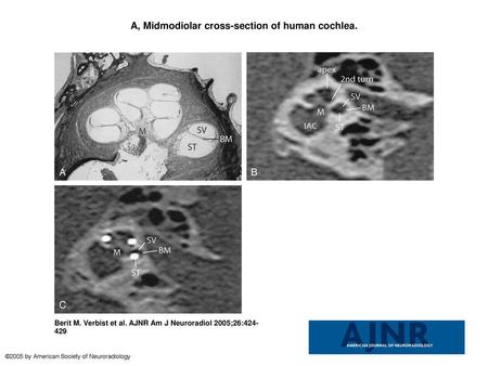 A, Midmodiolar cross-section of human cochlea.