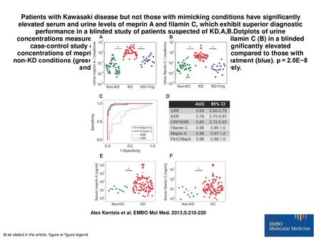 Patients with Kawasaki disease but not those with mimicking conditions have significantly elevated serum and urine levels of meprin A and filamin C, which.