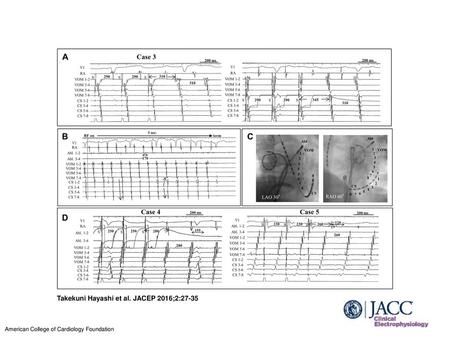 Takekuni Hayashi et al. JACEP 2016;2:27-35