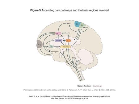 Figure 3 Ascending pain pathways and the brain regions involved