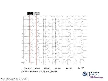 S.M. Afzal Sohaib et al. JACEP 2015;1: