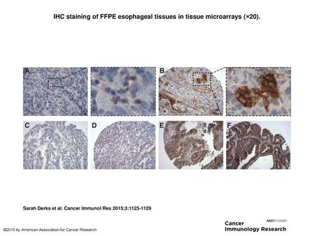 IHC staining of FFPE esophageal tissues in tissue microarrays (×20).