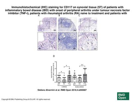 Immunohistochemical (IHC) staining for CD117 on synovial tissue (ST) of patients with inflammatory bowel disease (IBD) with onset of peripheral arthritis.