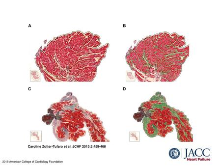 Caroline Zotter-Tufaro et al. JCHF 2015;3: