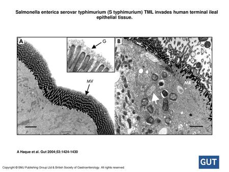  Salmonella enterica serovar typhimurium (S typhimurium) TML invades human terminal ileal epithelial tissue.  Salmonella enterica serovar typhimurium (S.