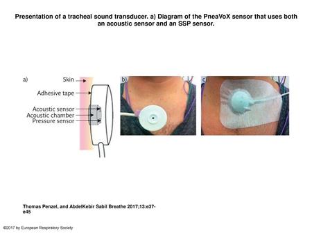 Presentation of a tracheal sound transducer