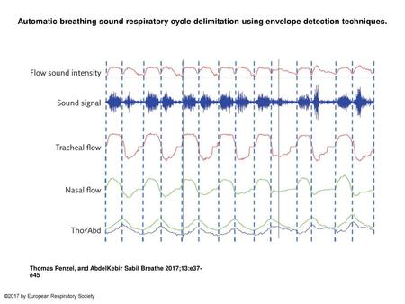 Automatic breathing sound respiratory cycle delimitation using envelope detection techniques. Automatic breathing sound respiratory cycle delimitation.