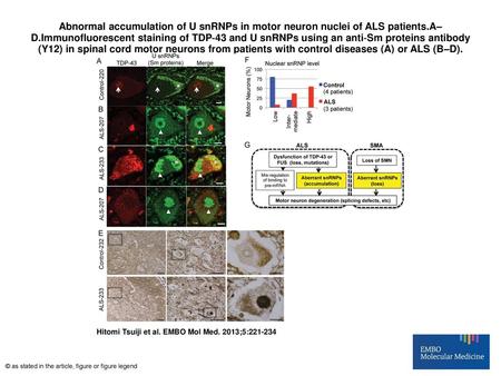 Abnormal accumulation of U snRNPs in motor neuron nuclei of ALS patients.A–D.Immunofluorescent staining of TDP‐43 and U snRNPs using an anti‐Sm proteins.