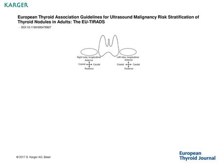 European Thyroid Association Guidelines for Ultrasound Malignancy Risk Stratification of Thyroid Nodules in Adults: The EU-TIRADS - DOI:10.1159/000478927.