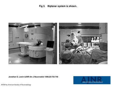 Fig 3. Biplanar system is shown.