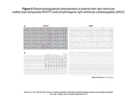 Nat. Rev. Cardiol. doi: /nrcardio