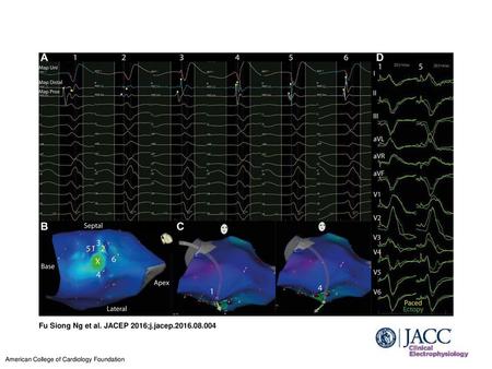 Fu Siong Ng et al. JACEP 2016;j.jacep