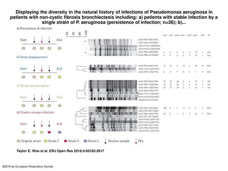 Displaying the diversity in the natural history of infections of Pseudomonas aeruginosa in patients with non-cystic fibrosis bronchiectasis including: