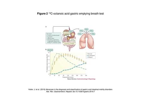 Figure 2 13C-octanoic acid gastric emptying breath test