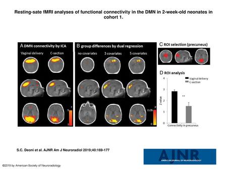 Resting-sate fMRI analyses of functional connectivity in the DMN in 2-week-old neonates in cohort 1. Resting-sate fMRI analyses of functional connectivity.