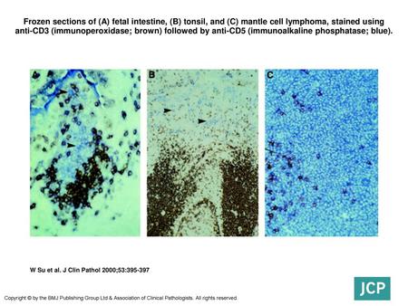 Frozen sections of (A) fetal intestine, (B) tonsil, and (C) mantle cell lymphoma, stained using anti-CD3 (immunoperoxidase; brown) followed by anti-CD5.