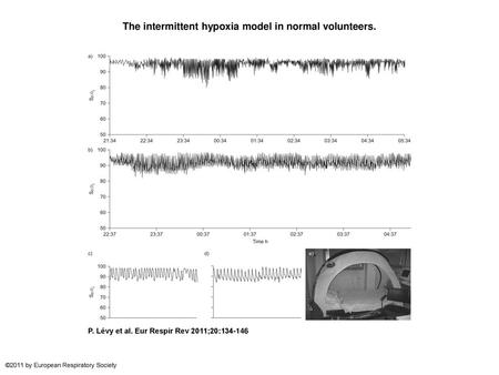 The intermittent hypoxia model in normal volunteers.