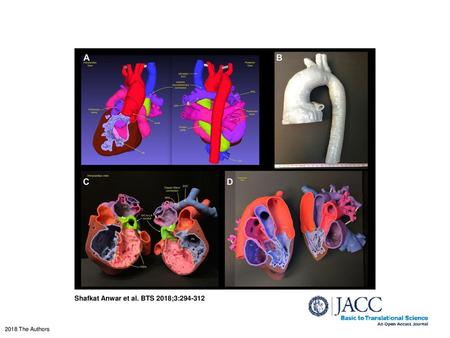 Shafkat Anwar et al. BTS 2018;3: