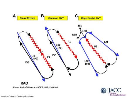 Ahmed Karim Talib et al. JACEP 2015;1: