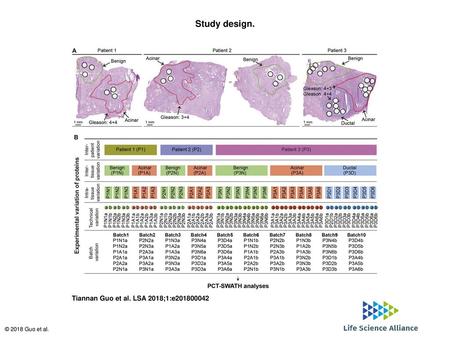 Study design. Study design. (A) Hematoxylin and eosin staining of the fresh frozen prostate tissue from three individuals who have contributed to BPH (non-tumorous)