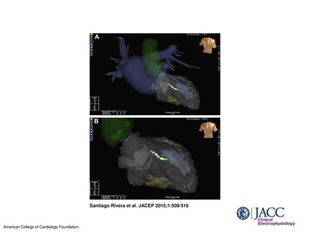 Santiago Rivera et al. JACEP 2015;1: