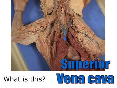 Superior Vena cava What is this?.