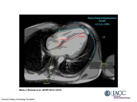 Maria J. Brosnan et al. JACEP 2015;1:84-91