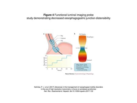 Figure 4 Functional luminal imaging probe