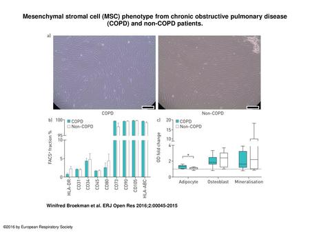 Mesenchymal stromal cell (MSC) phenotype from chronic obstructive pulmonary disease (COPD) and non-COPD patients. Mesenchymal stromal cell (MSC) phenotype.