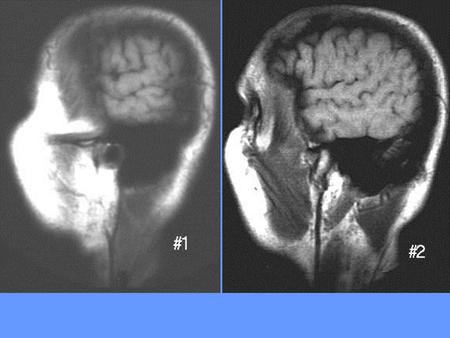 = not included as test image * Common carotid arteries (2) * Internal carotid arteries (2) * External carotid arteries (2) * Vertebral.