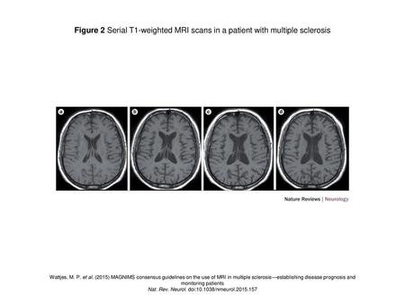 Nat. Rev. Neurol. doi: /nrneurol