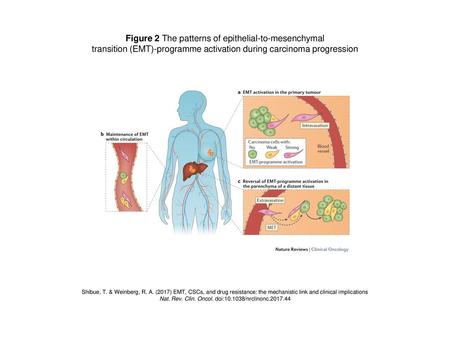 Figure 2 The patterns of epithelial-to-mesenchymal