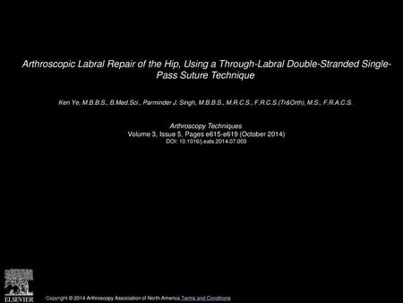 Arthroscopic Labral Repair of the Hip, Using a Through-Labral Double-Stranded Single- Pass Suture Technique  Ken Ye, M.B.B.S., B.Med.Sci., Parminder J.