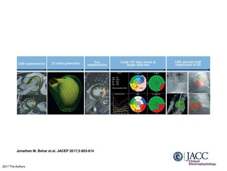 Jonathan M. Behar et al. JACEP 2017;3: